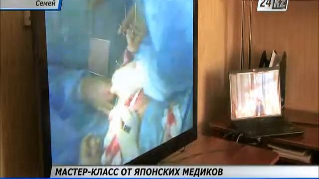 Семипалатинские онкологи перенимают опыт у японских медиков смотреть онлайн