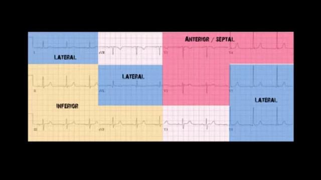 Echocardiography смотреть онлайн