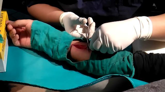 Un incidente un poco fatal смотреть онлайн