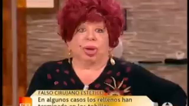 CARMEN CUENTA SU OPERACIÓN LABIOS 0001