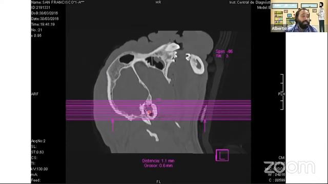 Casos Clínicos Complicados, CITOLOGÍA, OTITIS y MÁS - Alberto Martín Cordero смотреть онлайн