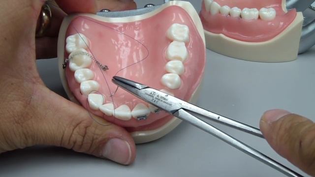 Root Coverage - Sling Suture смотреть онлайн