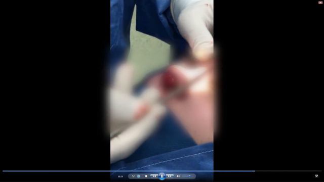 SAÚDE - INVITADO DR FERNANDO SERRANO TEMA RINOSEPTOPLASTIA смотреть онлайн