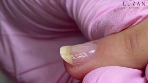 КАК ВЫРАВНИВАТЬ ВВЕРХ РАСТУЩИЕ НОГТИ-ТРАМПЛИНЫ