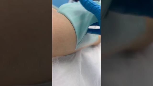 Все о самых современных техниках удаления волос в Epil Story! #депиляция #лазернаяэпиляция смотреть онлайн