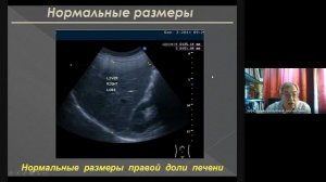 Оценка состояние печени и желчевыводящих путей с помощью ультразвукового метода исследования  Н Ю