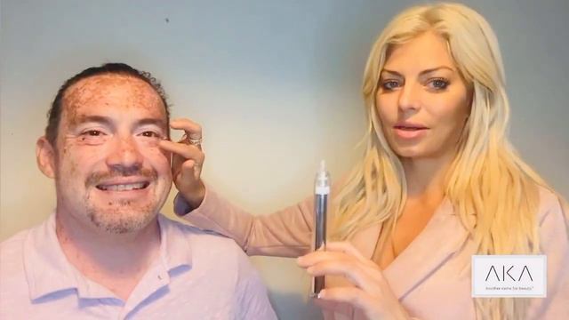 Best lift formula for eye bags and wrinkles treatment - Before and After images - Best lift formula смотреть онлайн