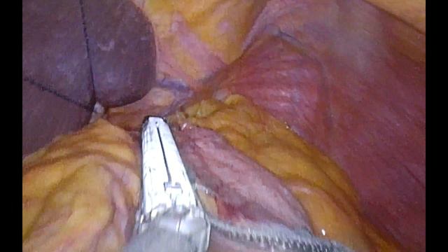 SASI Bypass "Made in Tivoli" смотреть онлайн