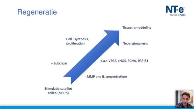 Shockwave Webinar 09/02/2021 смотреть онлайн