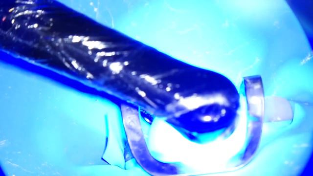 Step by Step Saving Lateral Hopeless Tooth #Part 1 | General Dentist Griya RR смотреть онлайн