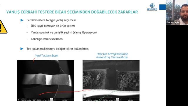 Cerrahi Motorlar Semineri смотреть онлайн