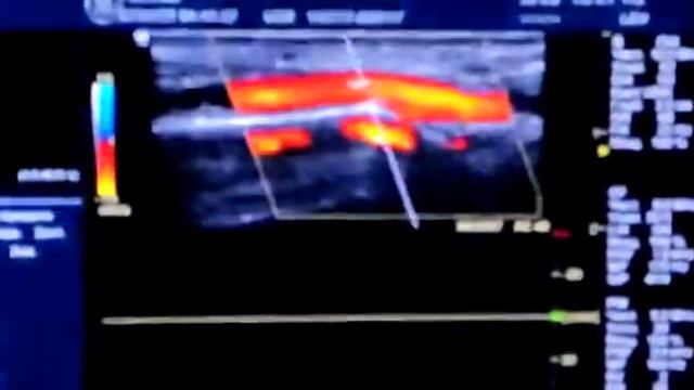 Практическое занятие 08-02-2022 №1. Артерии .....  (О.Л. Ерошенко)