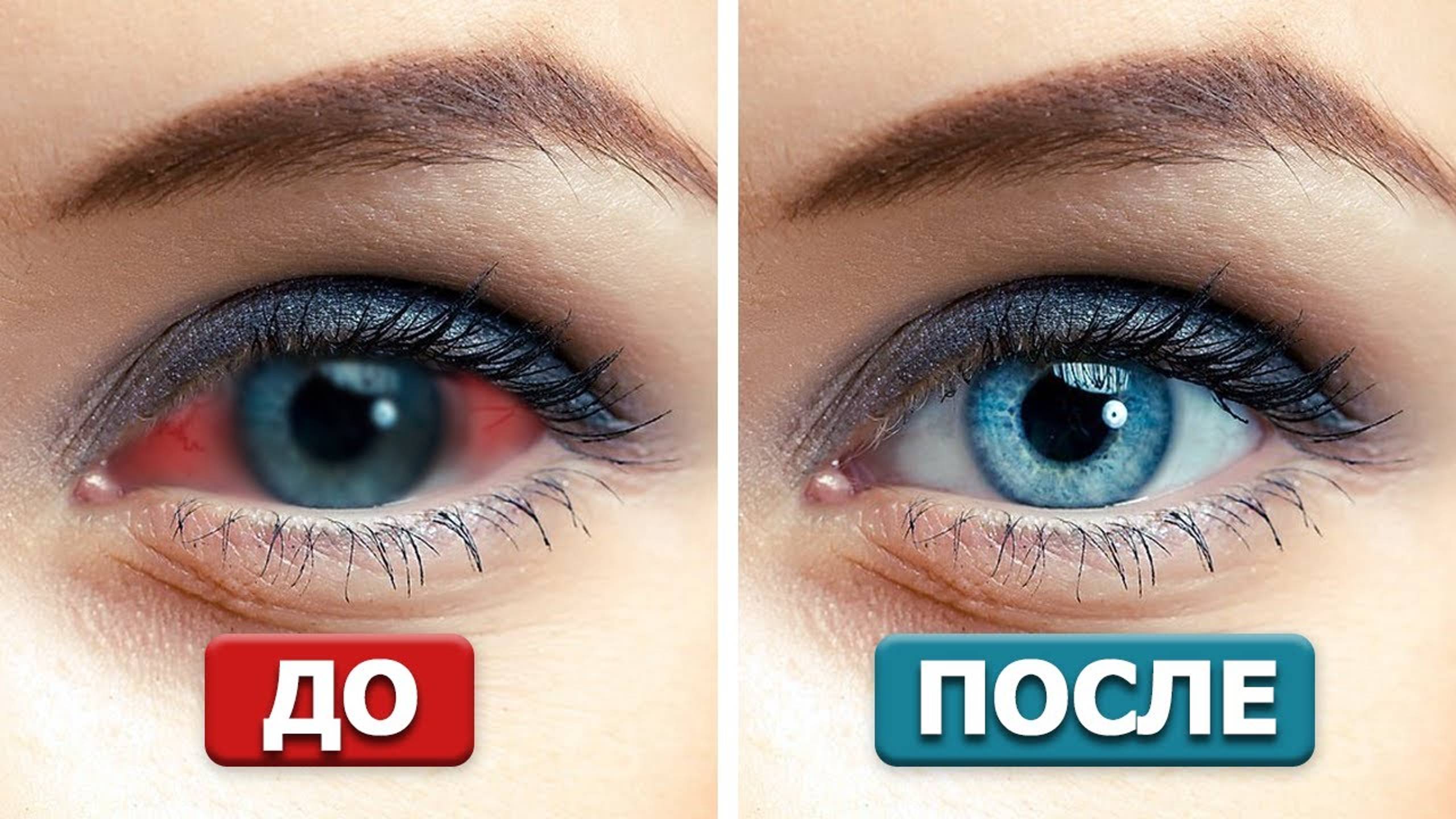 ОКУЛИСТЫ РАЗОРЯТСЯ! Три эффективные практики восстановят ЛЮБОЕ зрение! смотреть онлайн