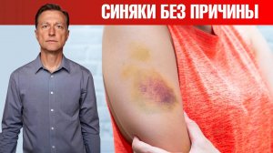 Почему появляются гематомы? Синяки на теле без причины🤷♀️