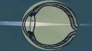 Физика. Глаз как оптическая система. Дефекты зрения