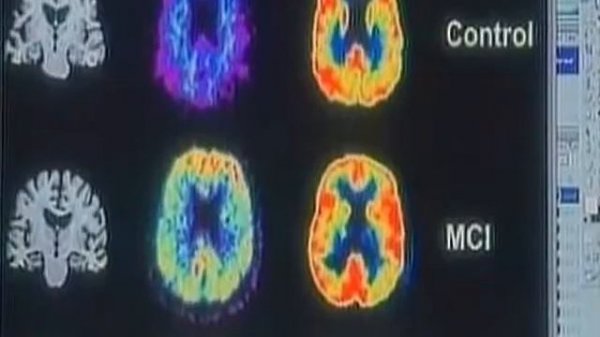 Скрытые резервы организма. Mеханизм самоoздоровления