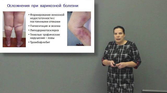Медики для немедиков: варикоз смотреть онлайн