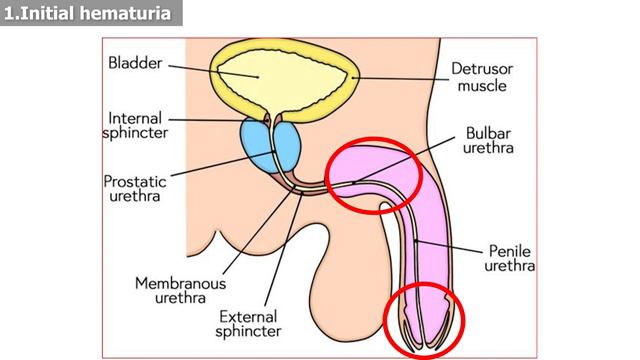சிறுநீரில் ரத்தம் கலந்து வெளியேறுதல் | Types of Hematuria | Timing of Hematuria | Dr A S Karthikeya смотреть онлайн