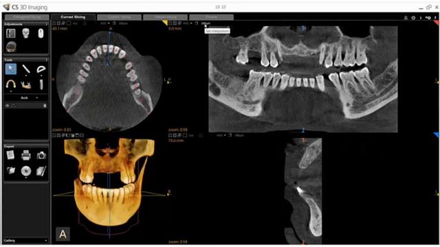 CS 3D Imaging software-Reconstructing a Panoramic Image смотреть онлайн