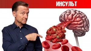 Как предсказать тихий инсульт?🤷♀️