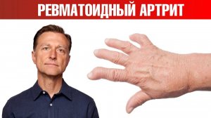 13 натуральных средств от ревматоидного артрита👌