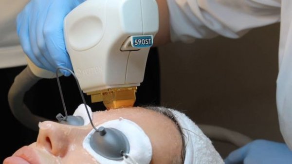 Фотоомоложение BBL