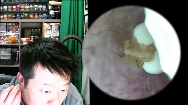 Ear wax removal cleaner with camera (Bebird C3 Review) смотреть онлайн