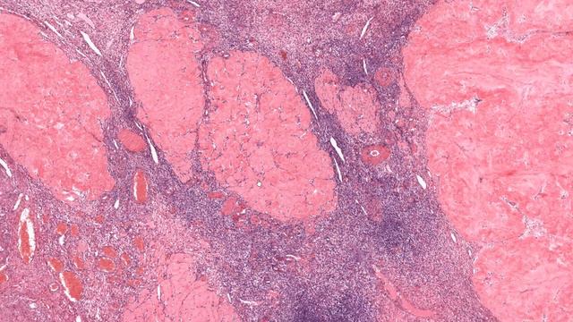 L’OVAIRE (Partie 3) - HISTOLOGIE смотреть онлайн