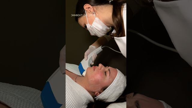 СМАС лифтинг лица на аппарате Ультраформер MPT | сеть клиник косметологии GEN87 смотреть онлайн