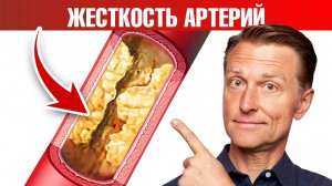 Кальцификация сосудов, жесткость артерий 👉 причина №1
