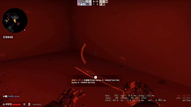 CSGO Zombie Escape ze_shroomforest3_p [ At the time of the event ] 2nd смотреть онлайн
