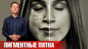 Как убрать пигментные пятна от солнца? Лучшее средство👍