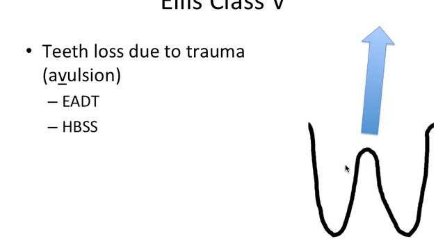Tooth Trauma- Ellis Classification смотреть онлайн