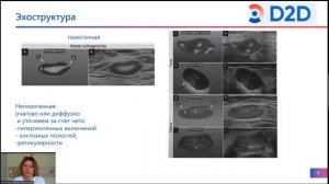 Как трактовать ультразвуковое исследование лимфатических узлов клиницисту?