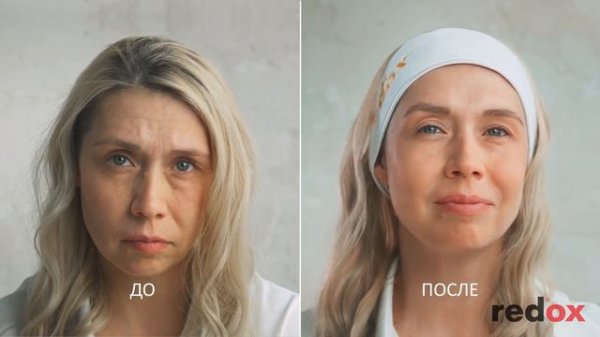 До и после - альгинатные маски redox