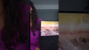 ПРОСТО О ВАЖНОМ: УМНЫЙ ЛИМФОДРЕНАЖ