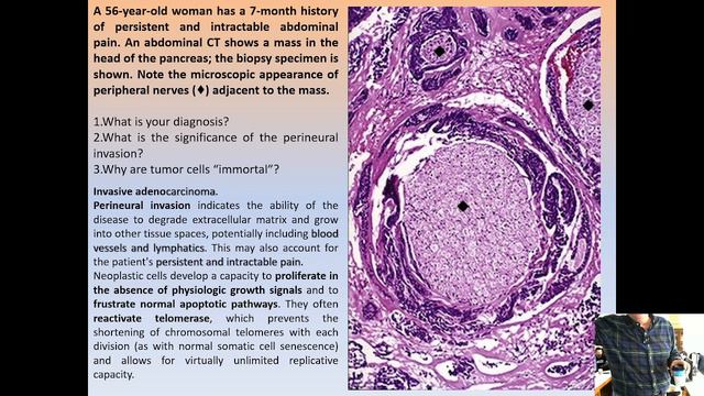NEOPLASIA CASES WITH IMAGES - 2ND PART смотреть онлайн