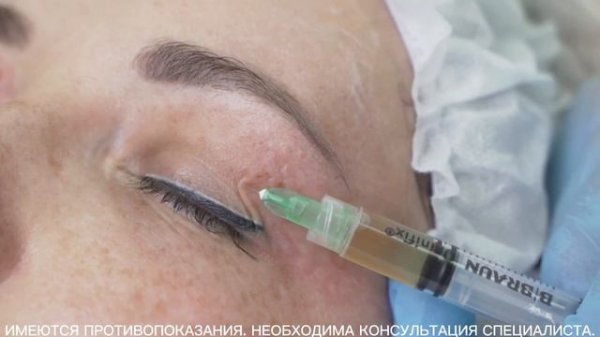 МАСТЕР-КЛАСС «Комбинированная терапия COLLOST® micro и PRP в одном шприце»