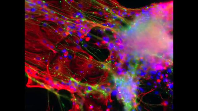 2015 Koch Institute Image Awards - Exhibition Opening смотреть онлайн