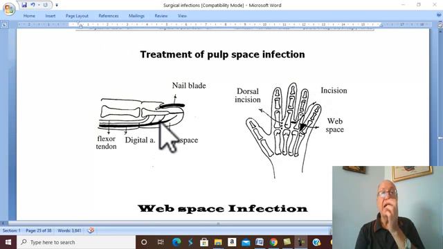 Surgical infections in English 6 ( Hand Infections, part 2 ) , by Dr. Wahdan смотреть онлайн