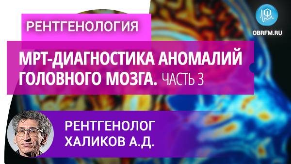 МРТ-диагностика аномалий головного мозга. Часть 3 смотреть онлайн