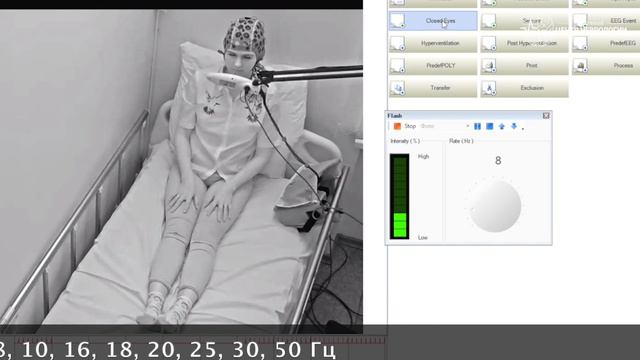 ЭЭГ смотреть онлайн