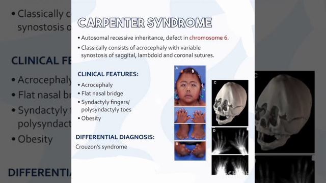 👒 Carpenter syndrome 👒 смотреть онлайн