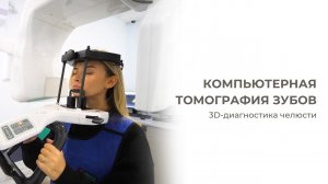 Компьютерная томография зубов и челюсти в стоматологии «Аквилио»