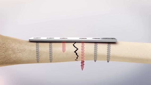 Click here for our latest video of the Electronic Depth Gauge (EDG®): https://youtu.be/E0q5g6XZYl0 смотреть онлайн