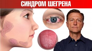 Самый эффективный протокол при синдроме Шегрена✅