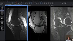 Врач на смене: Случай из практики коленный сустав
