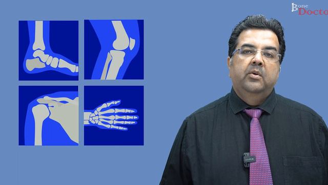 RIB FRACTURES - EPISODE 29 смотреть онлайн
