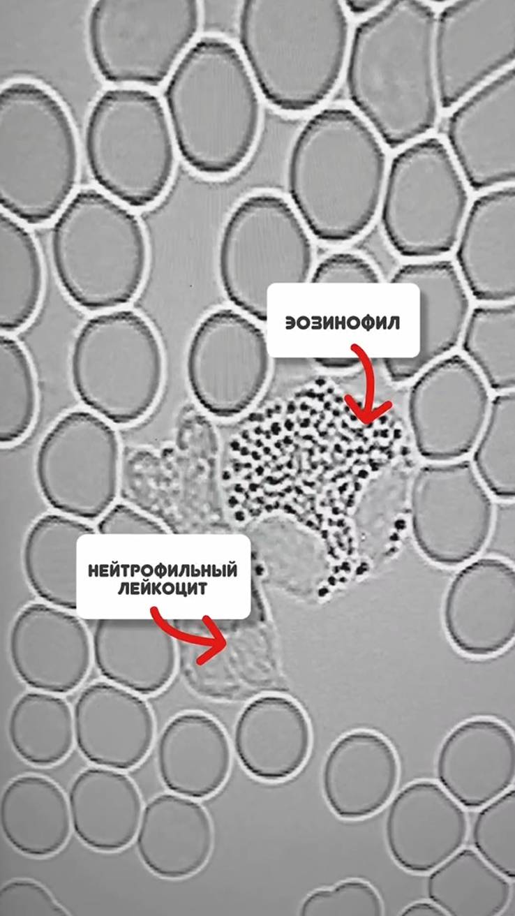 Клетки после серии очищающих программ смотреть онлайн
