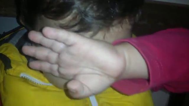 Eymutt çapada kaşına dikiş attiriyor🤕 смотреть онлайн
